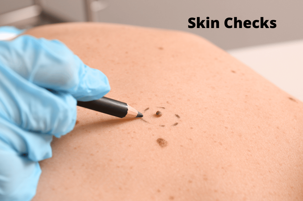 skin checks